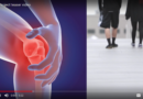 Discover the video of OActive: Transform and Accelerate the Osteoarthritis Diagnosis and Prediction Discover the video of OActive: Transform and Accelerate the Osteoarthritis Diagnosis and Prediction