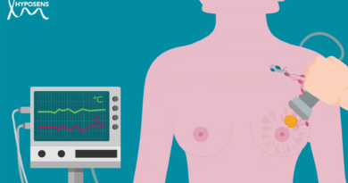 HYPOSENS releases video: better detection of breast cancer metastasis HYPOSENS releases video: better detection of breast cancer metastasis